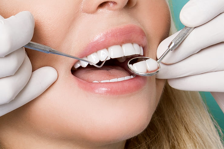 Lentes de contato x facetas de porcelana: conheça melhor os tratamento